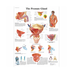 [독일3B] 전립선차트 VR1528L(코팅) The Prostate Gland Chart